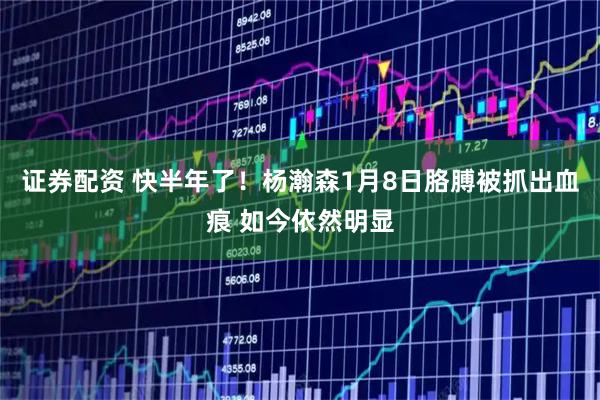 证券配资 快半年了！杨瀚森1月8日胳膊被抓出血痕 如今依然明显
